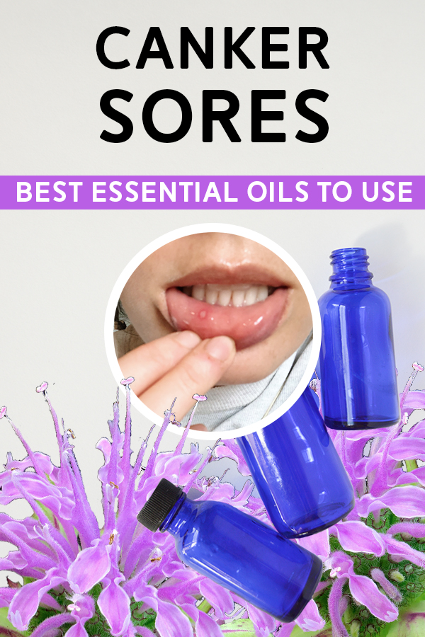 Best Essential Oils for Canker Sores + DIY Mouthwash Recipe - from a Certified Holistic Aromatherapist #essentialoils #aromatherapy